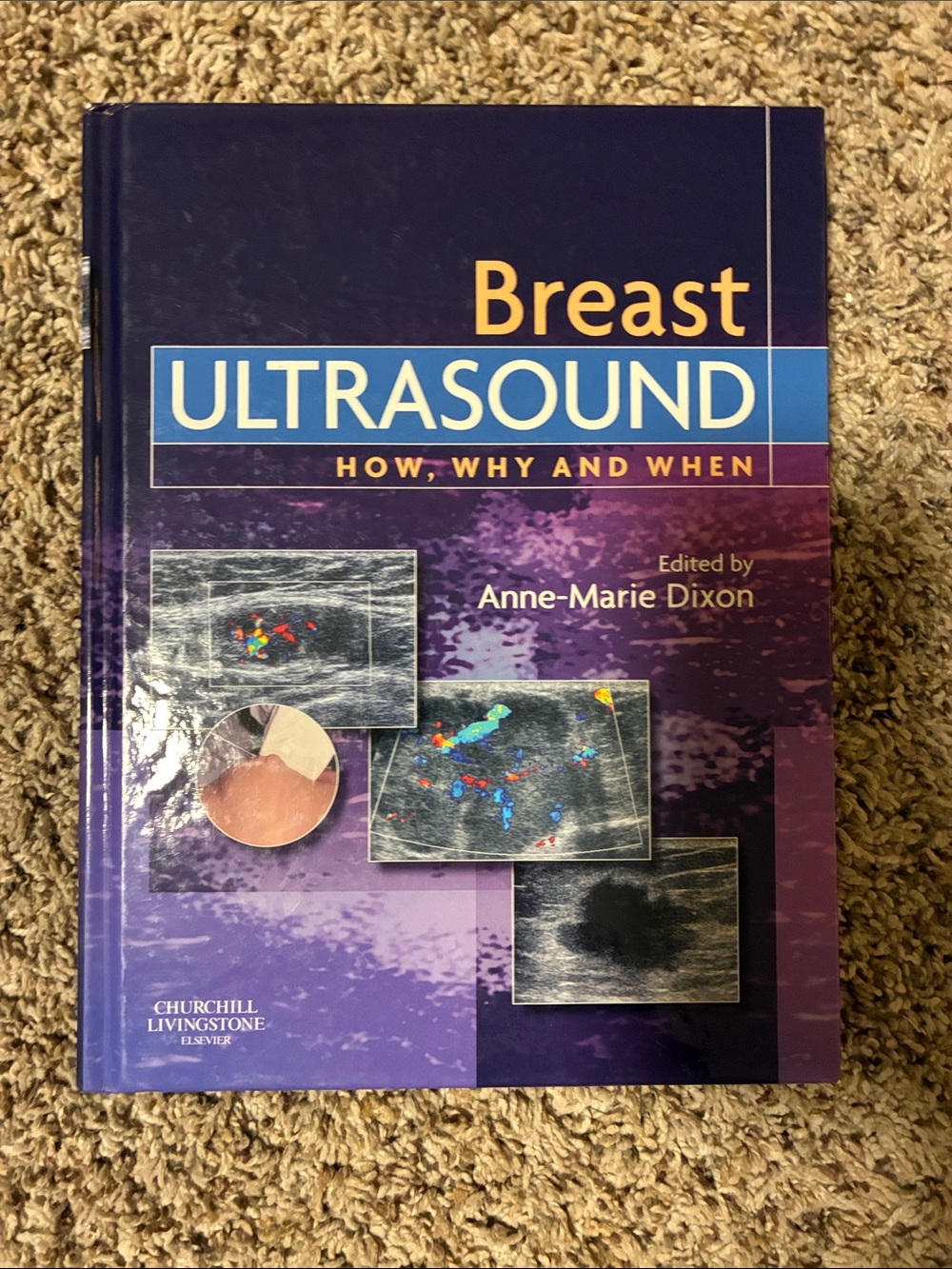 Breast ultrasound book